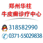 郑州最好的牛皮癣医院